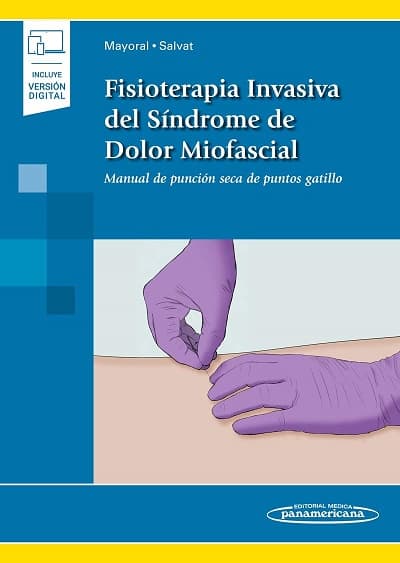 Fisioterapia Invasiva del Síndrome De Dolor Miofascial