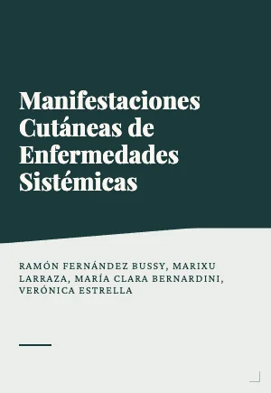 Manifestaciones cutáneas de enfermedades sistémicas