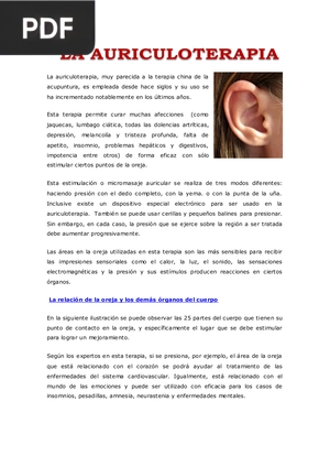 La Auriculoterapia