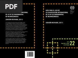 Guía para el uso de la Clasificación Internacional de la OIT de Radiografías de Neumoconiosis