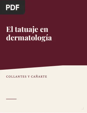 El tatuaje en dermatología