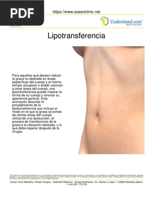 Lipotransferencia