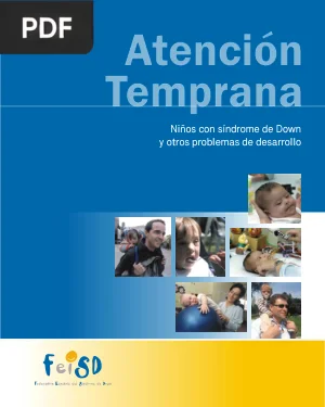 Niños con Síndrome de Down y Otros Problemas de Desarrollo (Atención Temprana)