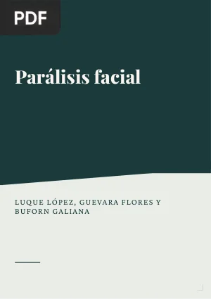 Parálisis facial