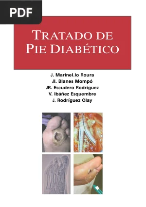 Tratado de Pie Diabético