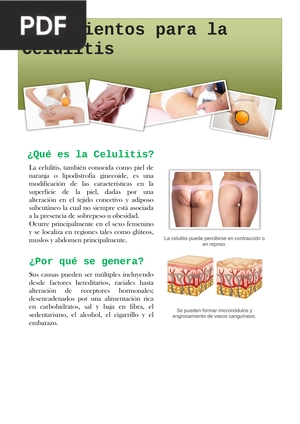 Tratamientos para la Celulitis